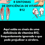 8 sintomas de deficiência de vitamina B12 - jamais ignore esses sinais 20250705-inserir-um-titulo