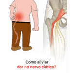 Dor no nervo ciático: 3 exercícios simples para aliviar o desconforto Imagem da página de origem