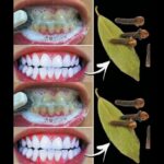Você sabe como remover tártaro e clarear os dentes naturalmente? Imagem da página de origem
