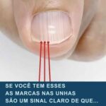 Suas Unhas Revelam Mais do que Você Imagina sobre seu corpo 719