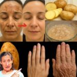 🌿 Como Usar Batata e Gengibre para uma Pele Perfeita da Forma Mais Natural e Eficaz 767