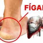 👣 O que seus pés podem dizer sobre sua saúde – 6 sinais de alerta que você não deve ignorar Imagem da página de origem