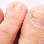 Minha avó confia nesta dica para reduzir a espessura das unhas. Descubra como funciona Imagem da página de origem