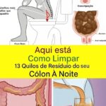🌿 Como Limpar 15 Quilos de Resíduos do Seu Cólon em Uma Noite e Reduzir a Gordura Abdominal 795