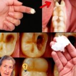 🦷 Formas Naturais de Prevenir Cáries e Fortalecer Seu Sorriso 807