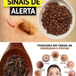 Cravo-da-Índia: Uma Solução Natural para Pólipos de Pele e Verrugas 836