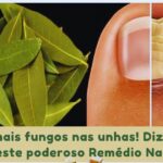 🌿 Louro para Fungos nas Unhas Imagem da página de origem