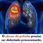 Câncer de Pulmão: A Crucial Importância da Detecção Precoce e os Sintomas Iniciais a Observar 1784ff56-715a-4c6c-b821-1d92cee9d8d1-1