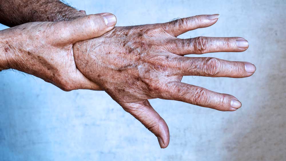 Selênio: Pele Radiante e Saúde Inabalável Agora!