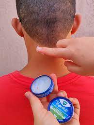 Vick VapoRub e Ponto Fengfu: Alivie Tensão com Essa Dupla