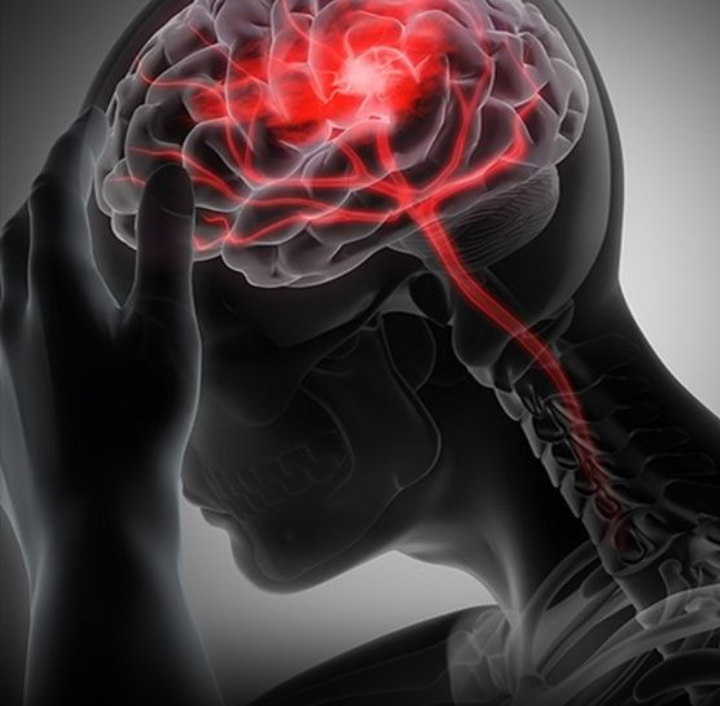 4 Hábitos Matinais que Aumentam o Risco de AVC