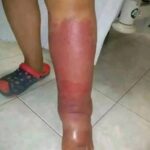 Inflamação na Pele: Sinais de Alerta e Abordagens Naturais para o Alívio 577170411_797079129816466_4618216032561894957_n