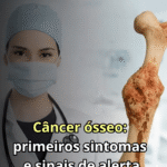 Câncer Ósseo: Sintomas e Sinais de Alerta que Você Precisa Conhecer 5f388bab-4984-46d9-a17d-5297b0de3d49