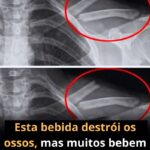 A Bebida Silenciosa: Desvendando o Impacto do Refrigerante na Saúde Óssea 6fac3480-0679-463d-adab-06fe4a7a8d92-1