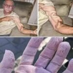 Dor Repentina no Braço ao Alongar: O Que Significa e Quando Procurar Ajuda Médica? 98d8bb62-ed3f-49c0-b5ec-7ccba0a54a31-1