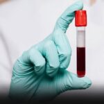 A Conexão Intrigante: Como Seu Tipo Sanguíneo Pode Influenciar o Envelhecimento a3b6537e-12b7-407e-a1e2-5f50a5f5c0ce