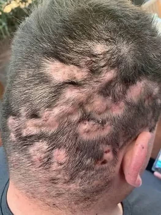 Sinais de Alerta Precoce: Entenda os Indícios de que Sua Saúde Pode Estar em Risco - Receitas De Ouro