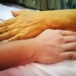 Fígado em Alerta: 6 Sinais na Pele que Podem Indicar Doença Hepática 5cde6d2a-41e7-46ab-9c06-0cb6021e9675