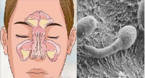 Nariz Entupido? Sua Solução Começa no Intestino!